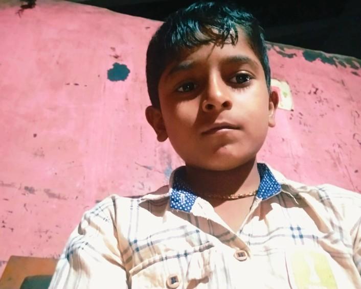 Boy dies, sister hospitalised after suspected snakebite in Sirsi